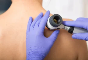 Skin cancer screening (1)