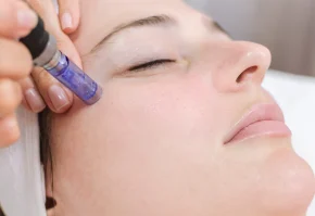 microneedling